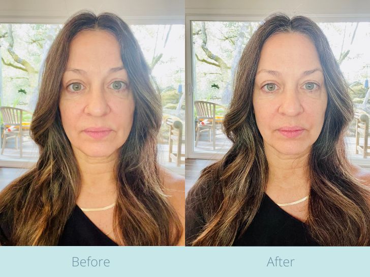 Before and after photos of Kristen Philipkoski to show the instant results of using the FOREO BEAR.