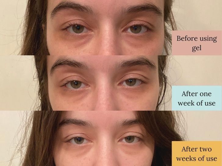 Side by side comparison of undereye bag reduction with Glow Recipe's Guava Vitamin C Bright-Eye Gel