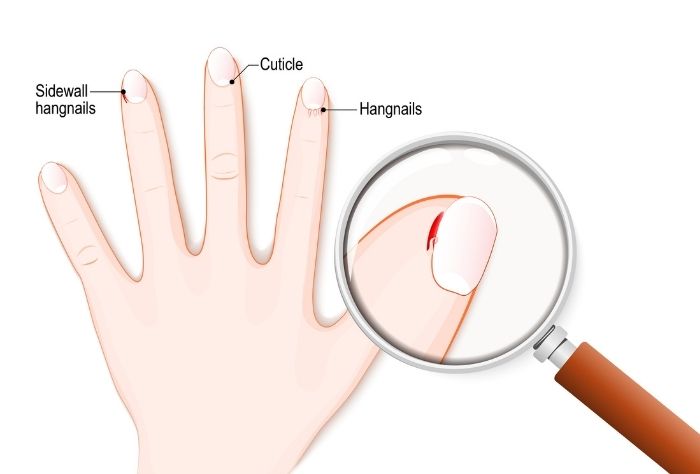 Hangnail and cuticle diagram with magnifying glass